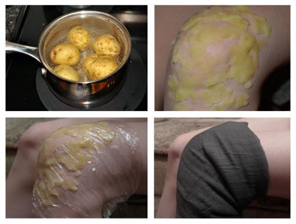 Korištenje krumpira na toplom zgloba